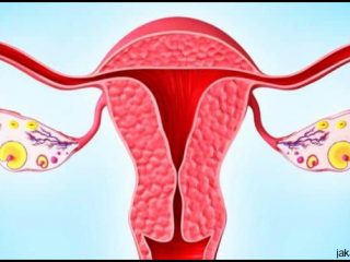 Mengungkap Fakta: Kanker Rahim Adalah Ancaman Serius bagi Wanita