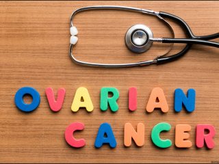 Mengungkap Misteri Penyebab Kanker Ovarium: Apa yang Harus Anda Ketahui?